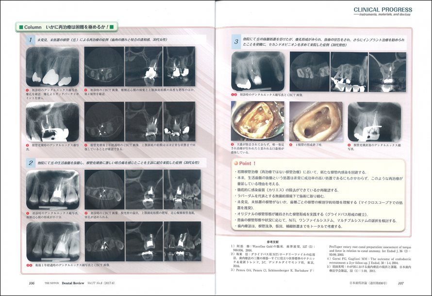 日本歯科評論 ８月号に掲載されました。